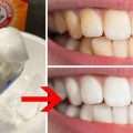 The Ultimate Guide: Using Baking Soda for Teeth Whitening